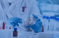 Labortechniker untersucht Schimmelprobe in einer Petrischale unter Laborbedingungen.