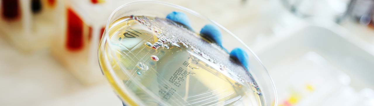 Commercial Microbe Testing Microbiological Analysis Services | TÜV SÜD Malaysia