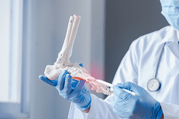 Additive Manufacturing for Orthopedic Implants