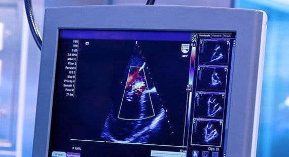 Single Fault Safety Requirements in the MDR
