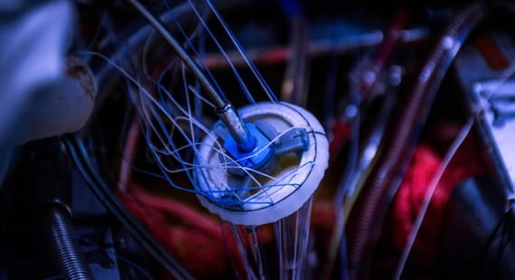 Cardiovascular Medical Devices