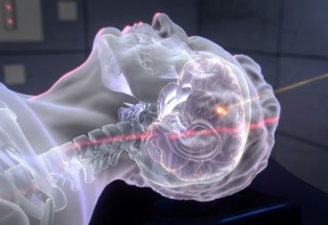 Protonenstrahltherapie